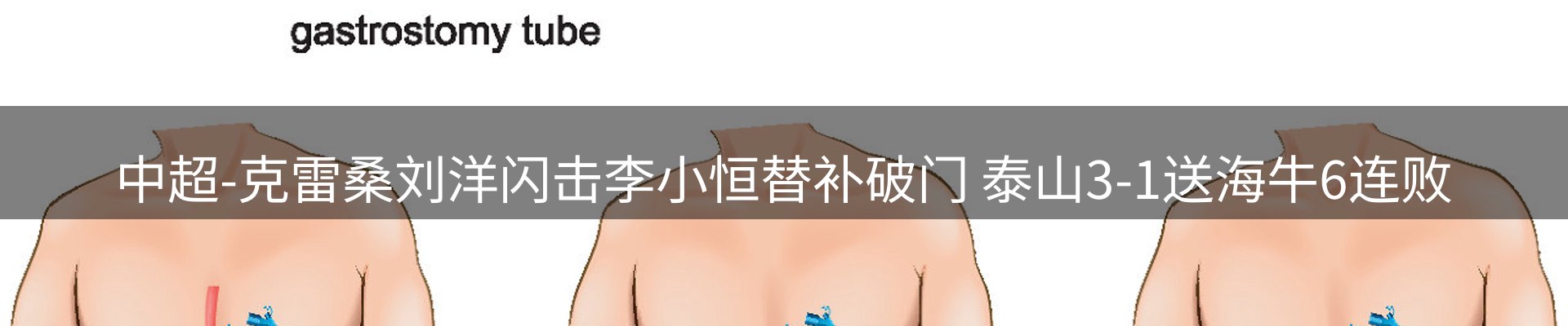 体育资讯